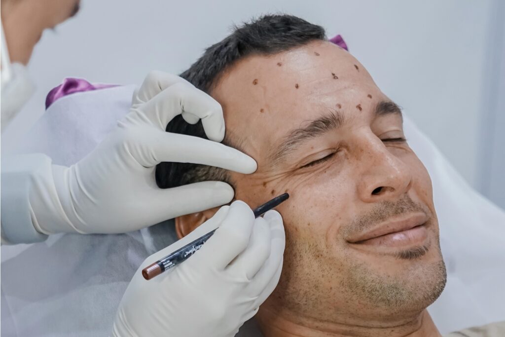 Aman Kah Mendapatkan Botox atau Filler di Bali?