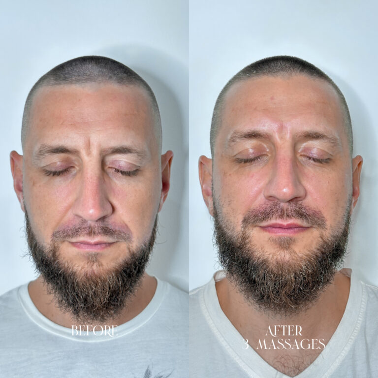 Signature Face Lifting Massage