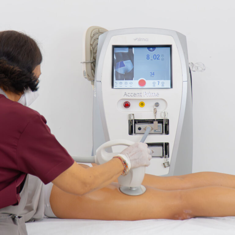Alma Accent Prime — Body Lab Bali
