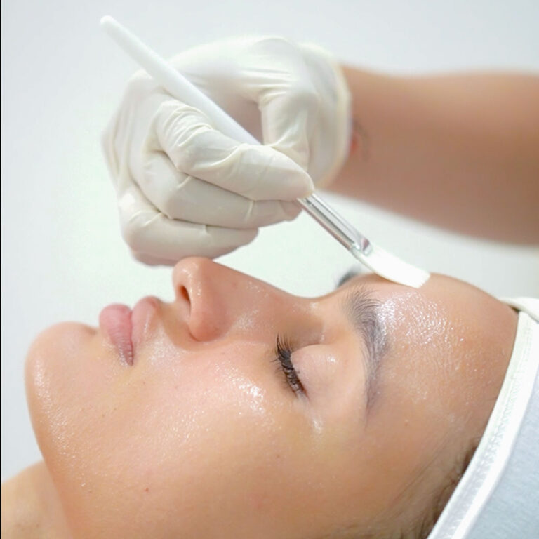 Retinol Peel — Body Lab Bali