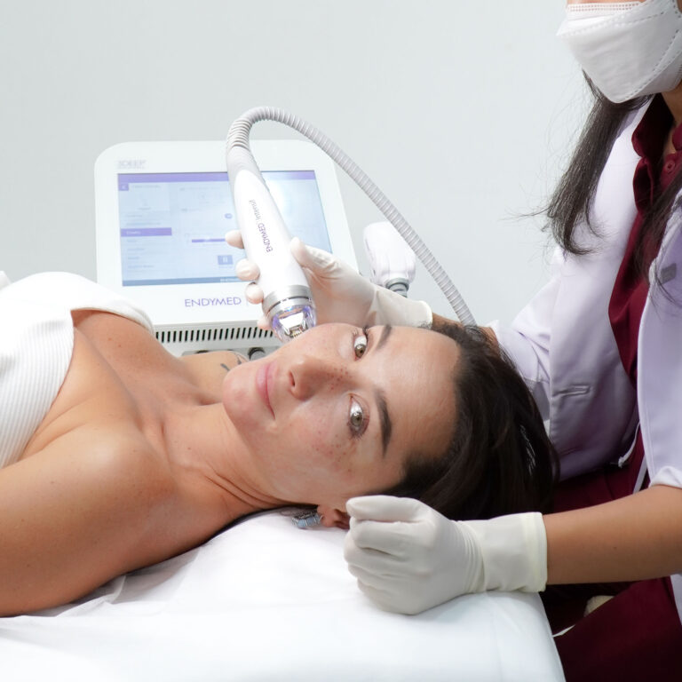 Microneedling — Body Lab Bali