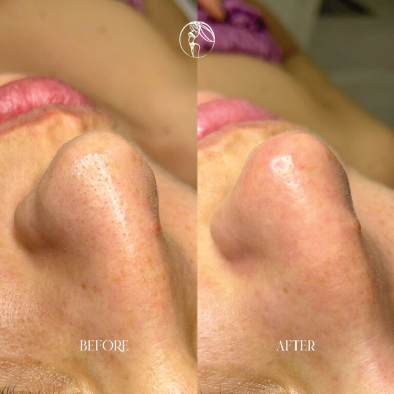 Deep Cleansing Facials
