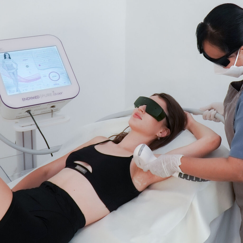 Laser Hair Removal