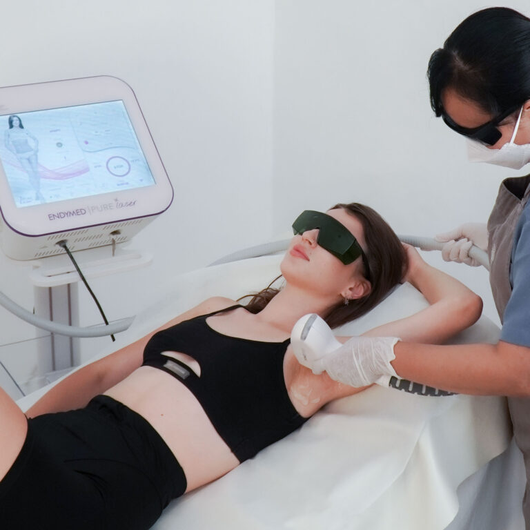 Laser Hair Removal